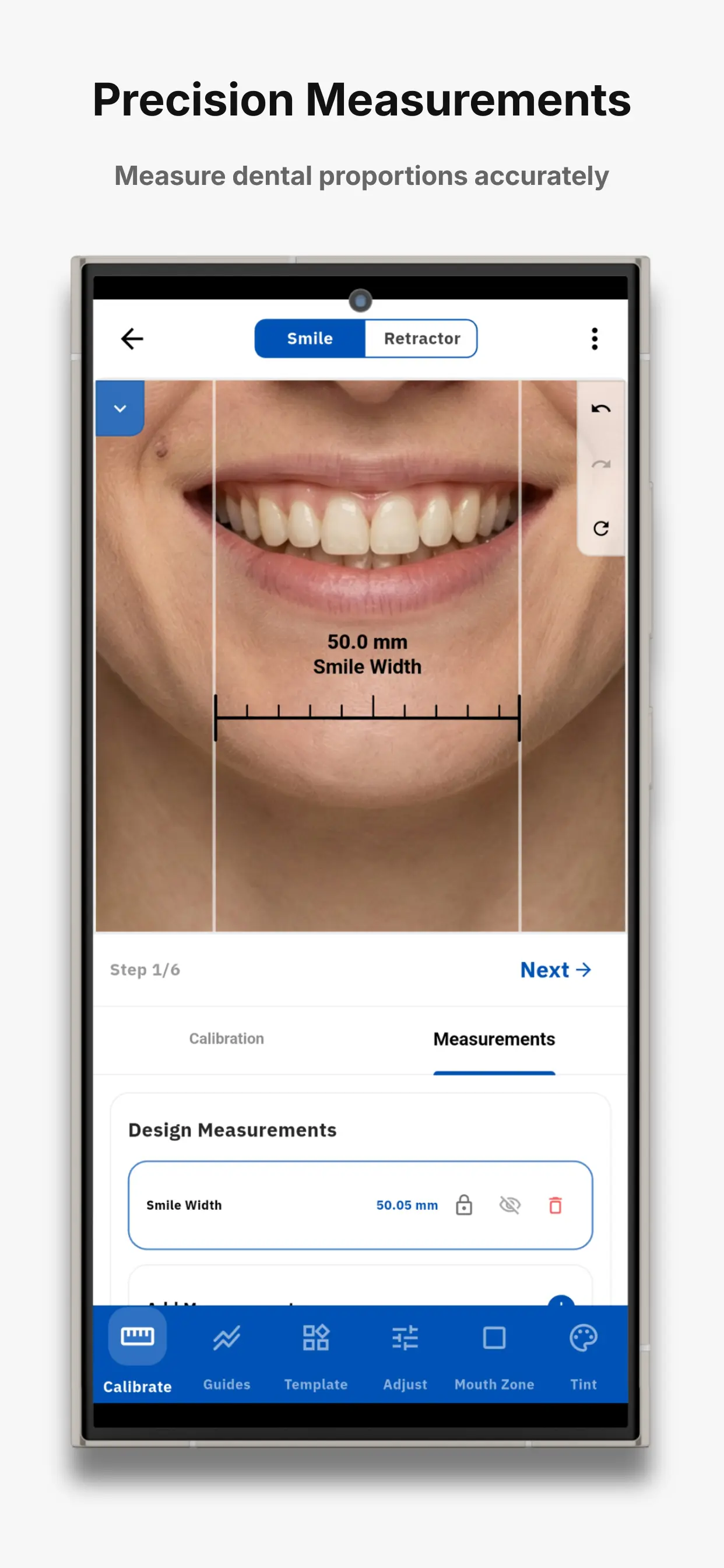 SmileX facial analysis screen