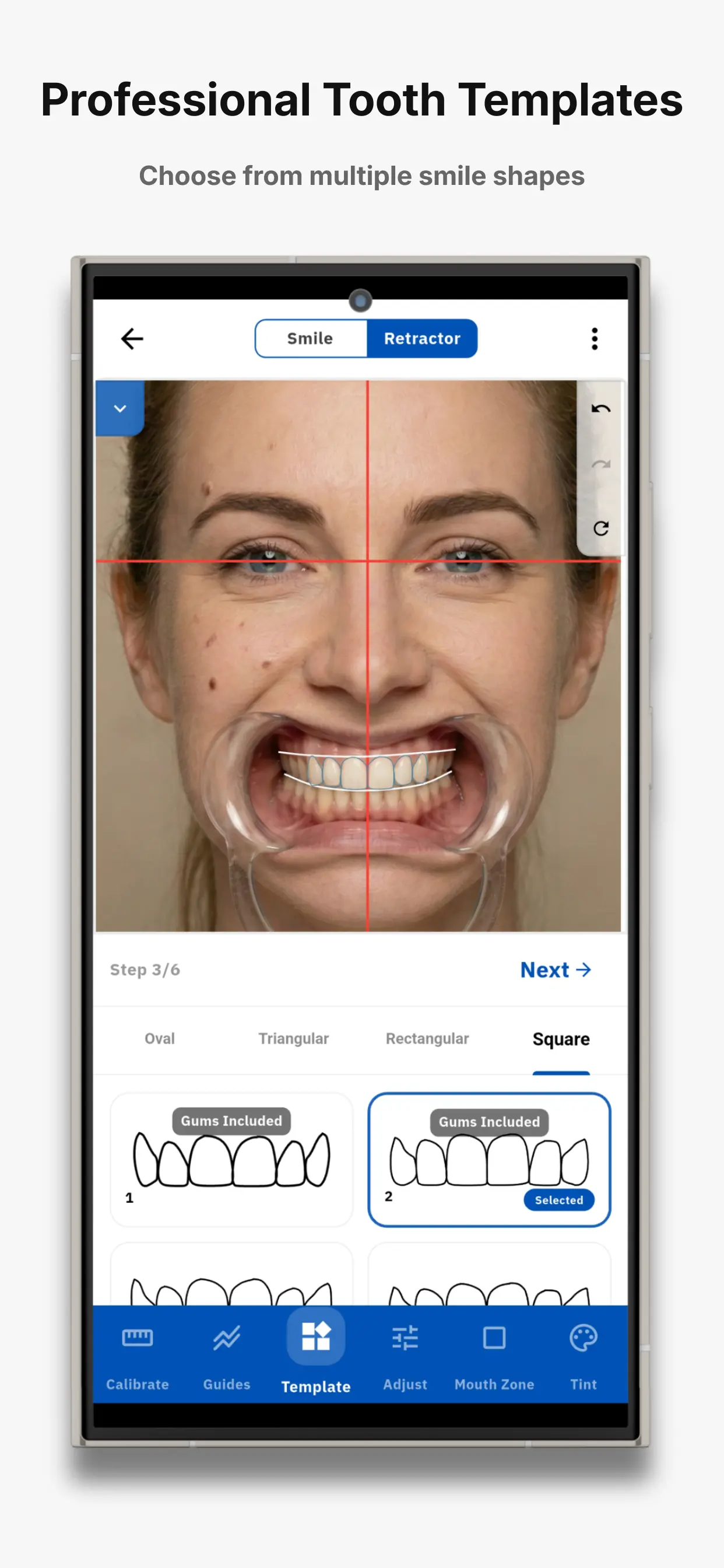 SmileX smile design screen