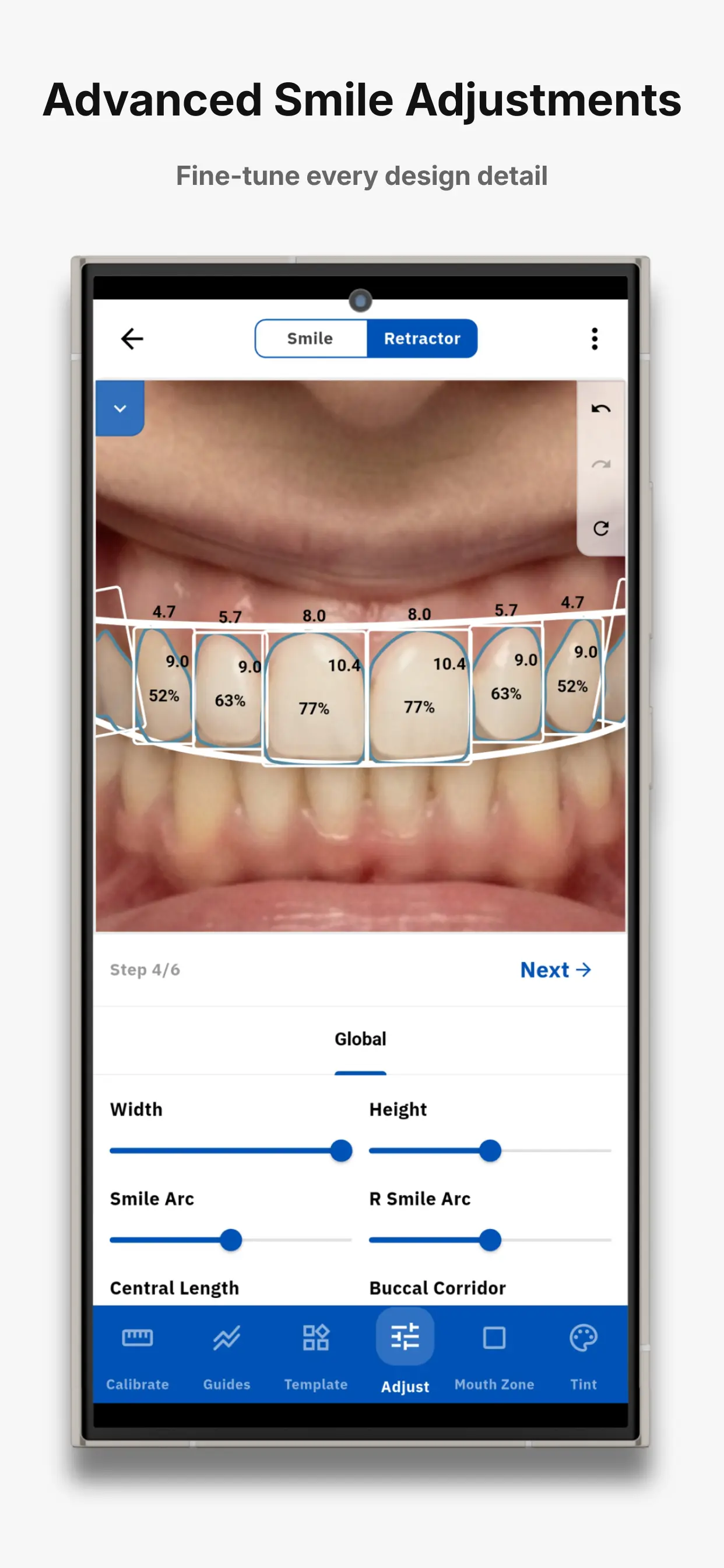 SmileX proportion tools