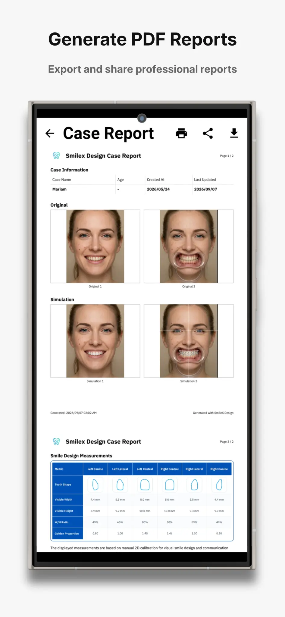 SmileX report preview